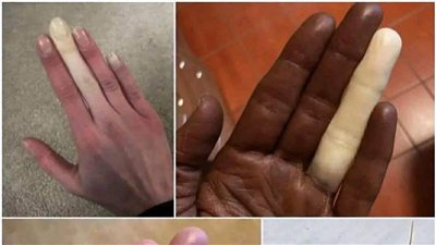 احذر مليون مرة قبل ملامسة هذه الحشره