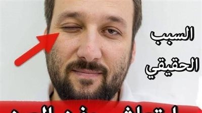 هل تعلم على ماذا يدل إرتجاف العين ما الذي يحاول أن يقوله لك جسـمك 